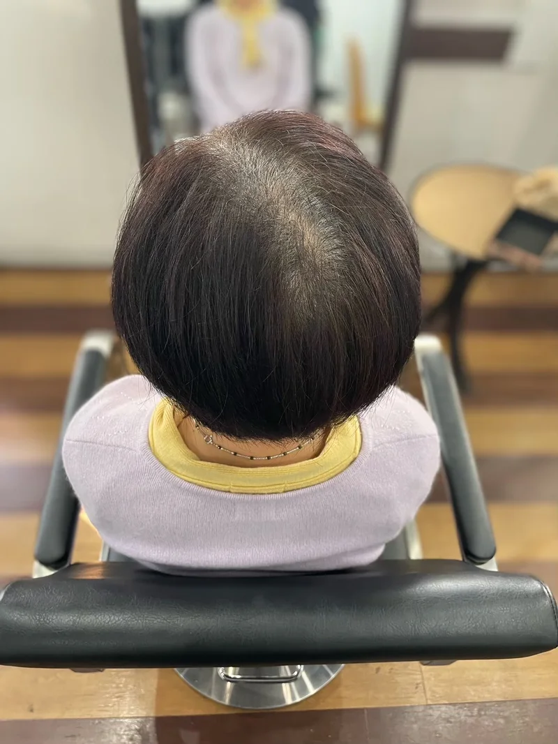 施術前